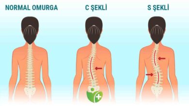 Skolyoz derecesi kızlarda daha hızlı ilerliyor! 1