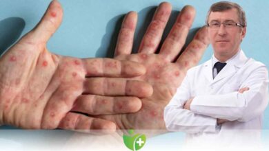 Maymun çiçeği virüsü nedir ve nasıl bulaşır? 5