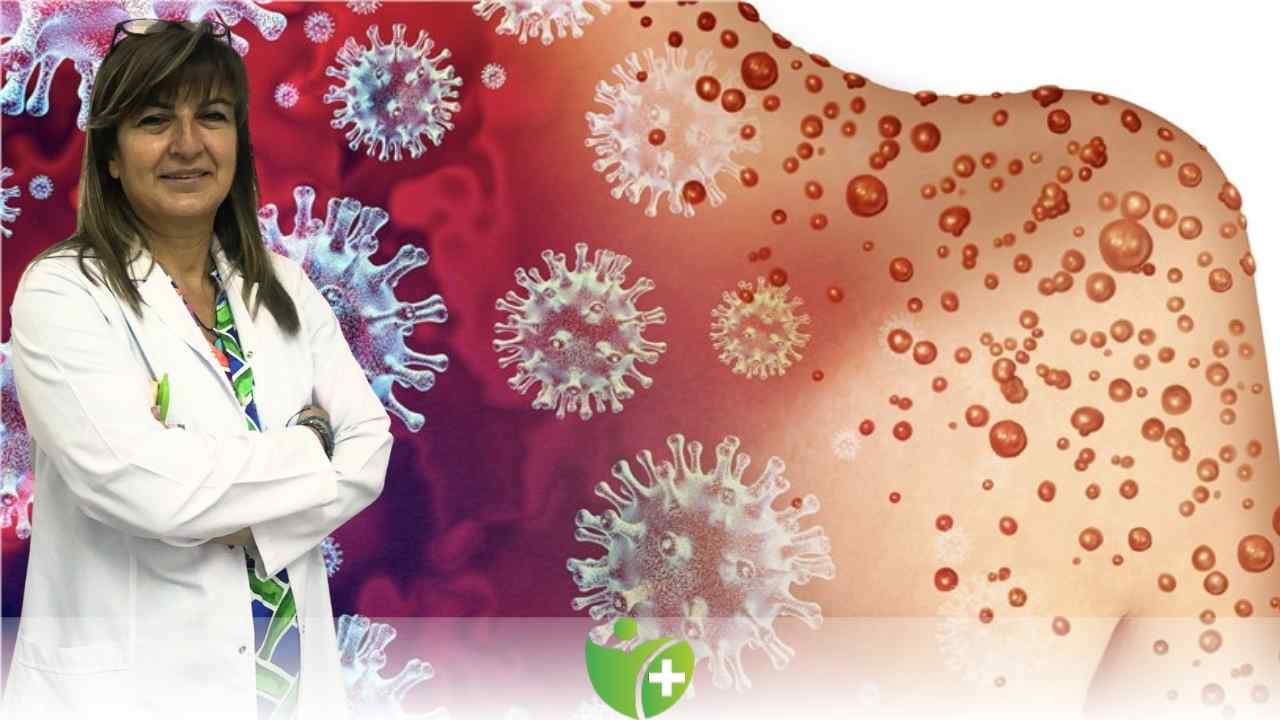 Sırada maymun çiçeği var mı? 7