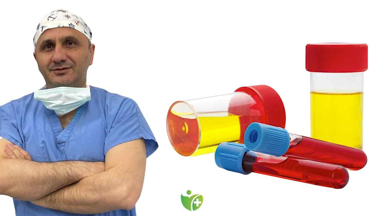 İdrarda kan görülmesi mesane kanseri habercisi olabilir! 7