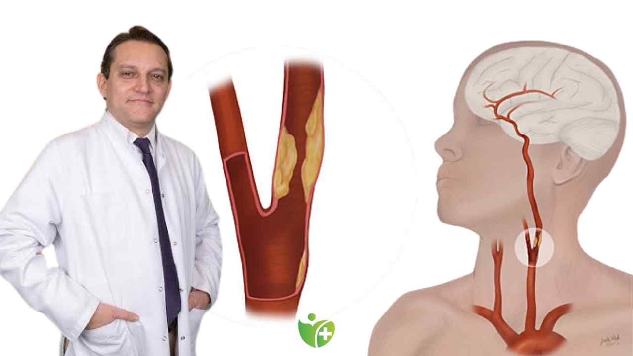 Boynumuzdaki sinsi tehdit Şah damarı tıkanıklığı! 7