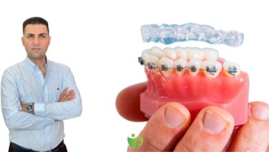 Sahte diş tellerine Dikkat 1