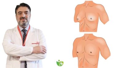 Bu 8 belirti Jinekomastiye işaret ediyor 1