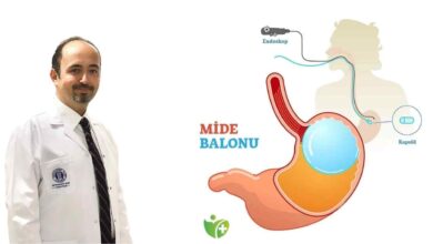 Mide Balonu ile Fazla kilolara veda 1