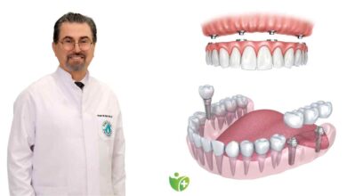Uzmanı açıkladı, İmplant mı, protez mi tercih edilmeli? 11