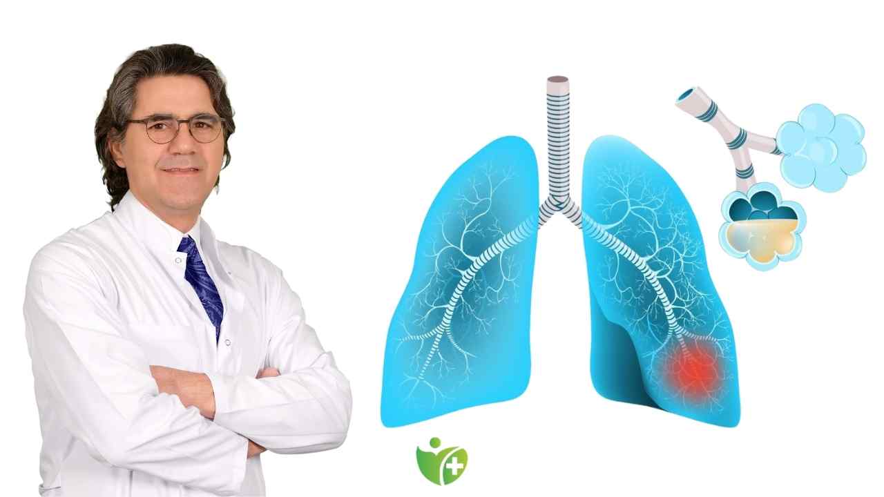 Zatürre Görülme sıklığı sonbahar ve kış mevsiminde artıyor! 7