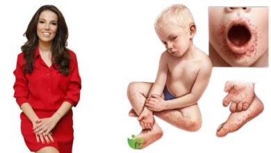 Bebeklerde görülen ağız hastalıklarına dikkat: Erken teşhis hayat kurtarır! 1