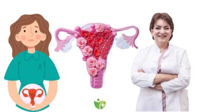 Polikistik over sendromu (PCOS,PKOS) nedir? 13