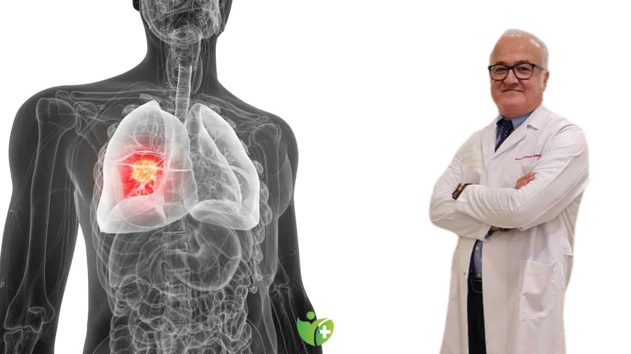 Akciğer Kanseri olanlar için Sauna ve Hamam kullanımı: Dikkat edilmesi gerekenler 7