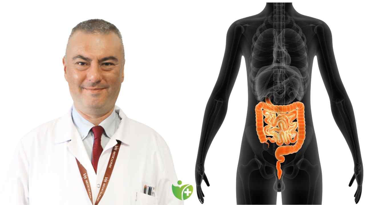 Kalın bağırsak kanserinde Poliplerin Kritik rolü 7