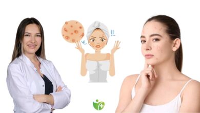 Aknenin Konumu ve vücudunuzun verdiği ipuçları 14