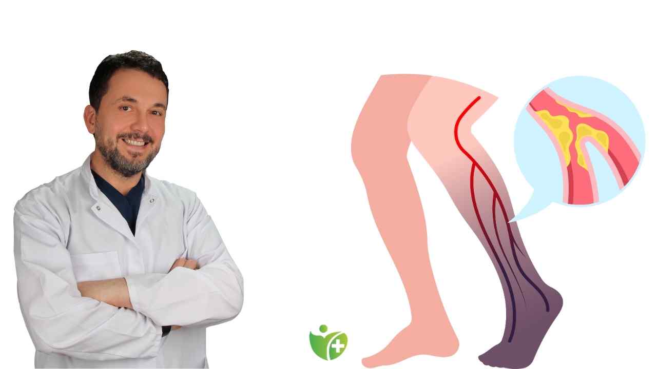 Bacak sağlığınızı tehdit eden gizli düşman: Derin ven trombozu! 7