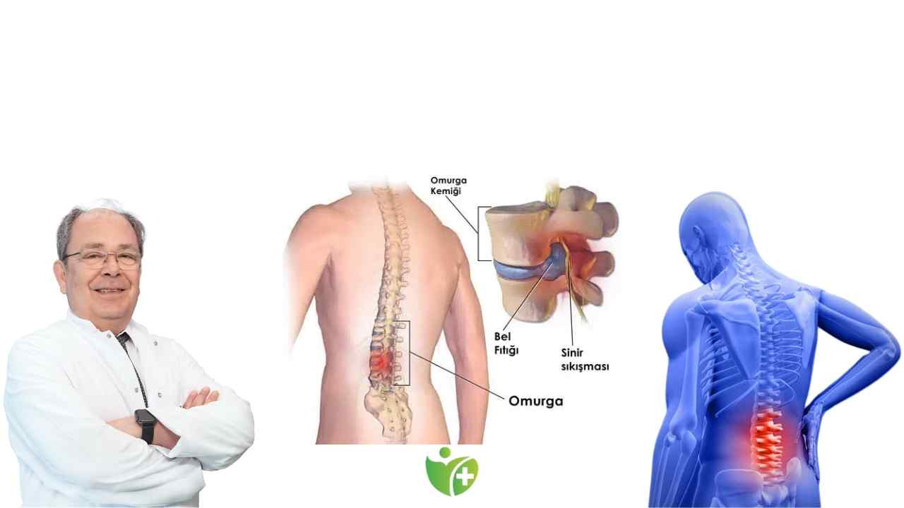 Bel Fıtığı hakkında kulaktan dolma 7 Bilgiye kanmayın! 7