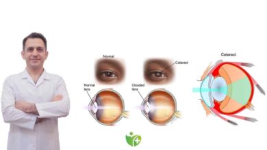 Katarakt Riskini azaltmak mümkün mü? İşte yanıtı!" 2