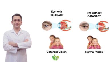 Katarakt hakkında Bilinen Yanlışlar ve Bilimsel gerçekler! 3