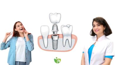 İmplant tedavisiyle ilgili Doğru sanılan yanlışlar ve gerçekler 1