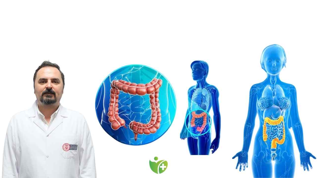 Kolon Kanseri belirtisiz ilerleyebilir! Geç kalmadan önleminizi alın 7