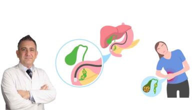 Safra Kesesi Taşları hakkında şaşırtan Doğrular ve Yanlışlar 2