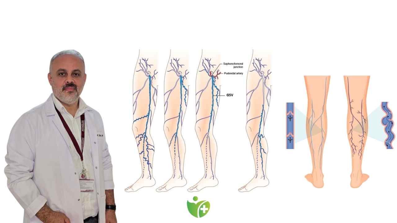 Varis konusunda kafanız mı karışık? İşte gerçekler" 7