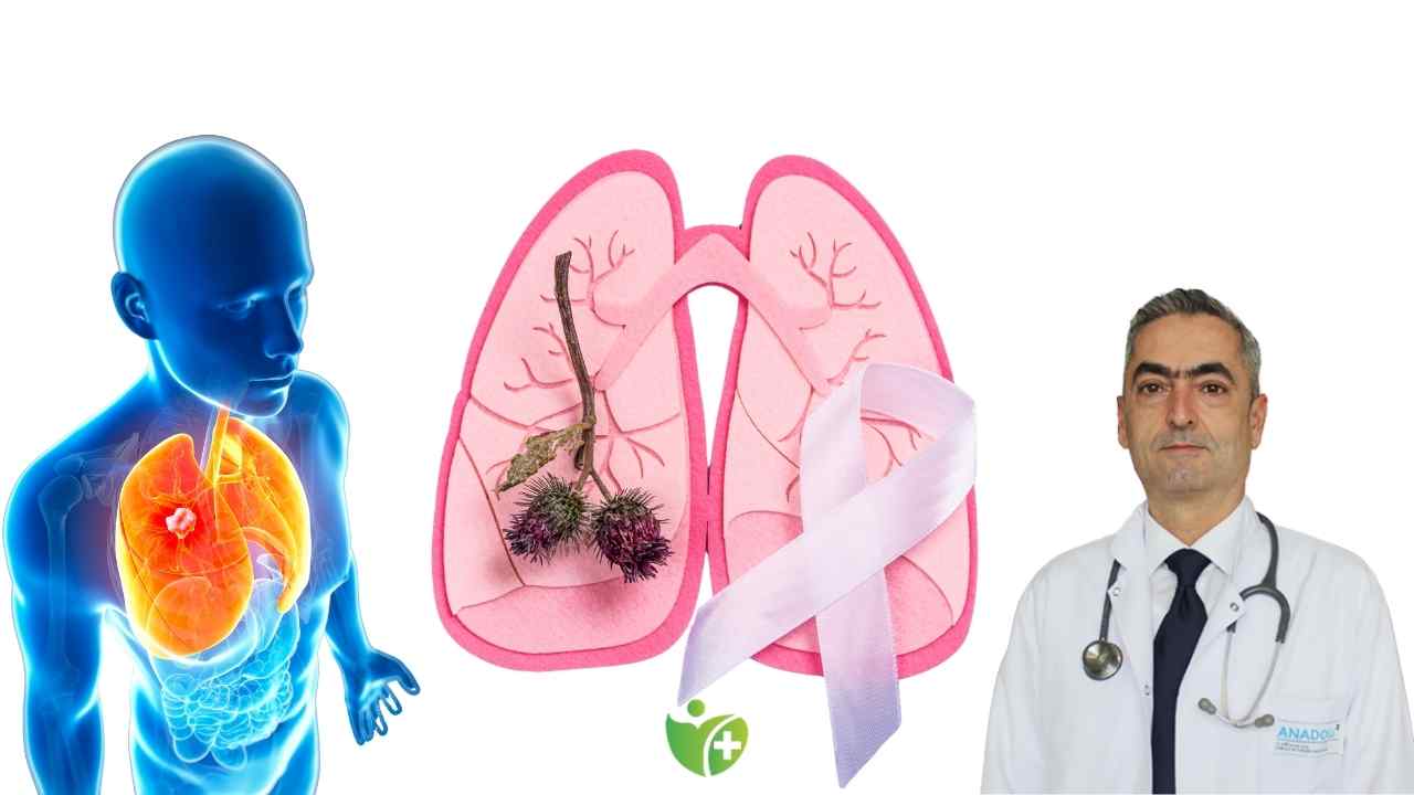 Akciğer Kanseri erken teşhisinde yıllık taramanın önemi 7