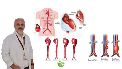 Aort Diseksiyonu nedir? Belirtileri ve hayat kurtaran önlemler 7