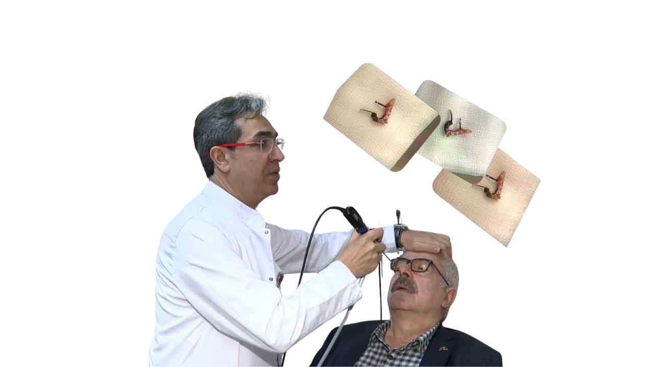 Burnundaki 30 yıllık küpeyle vedalaştı: Recep Usta’nın Bezmiâlem’deki mucizesi 7