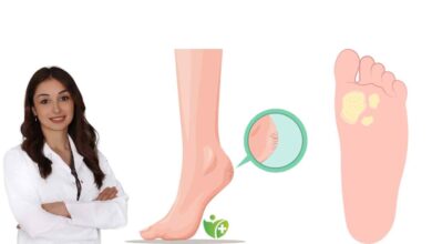 Nasır neden çıkar? Belirtileri ve Doğal tedavi önerileri 2