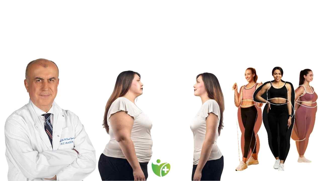 Diyet ve Egzersiz yetmiyor: İnatçı Obezite vakaları artıyor 7