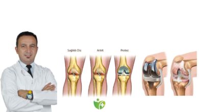 Total diz Protezi Hakkında bilmeniz gereken her şey 1