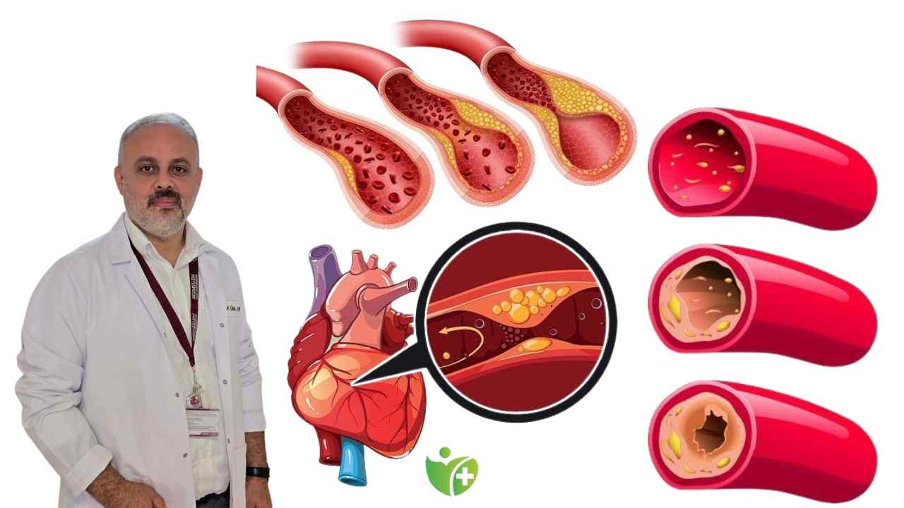 Gençler Alarmda! Damar tıkanıklığı yaşa bakmıyor! 6