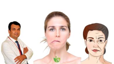 Aniden yüzünüz kayıyorsa Dikkat! İşte inmenin kritik belirtisi 16