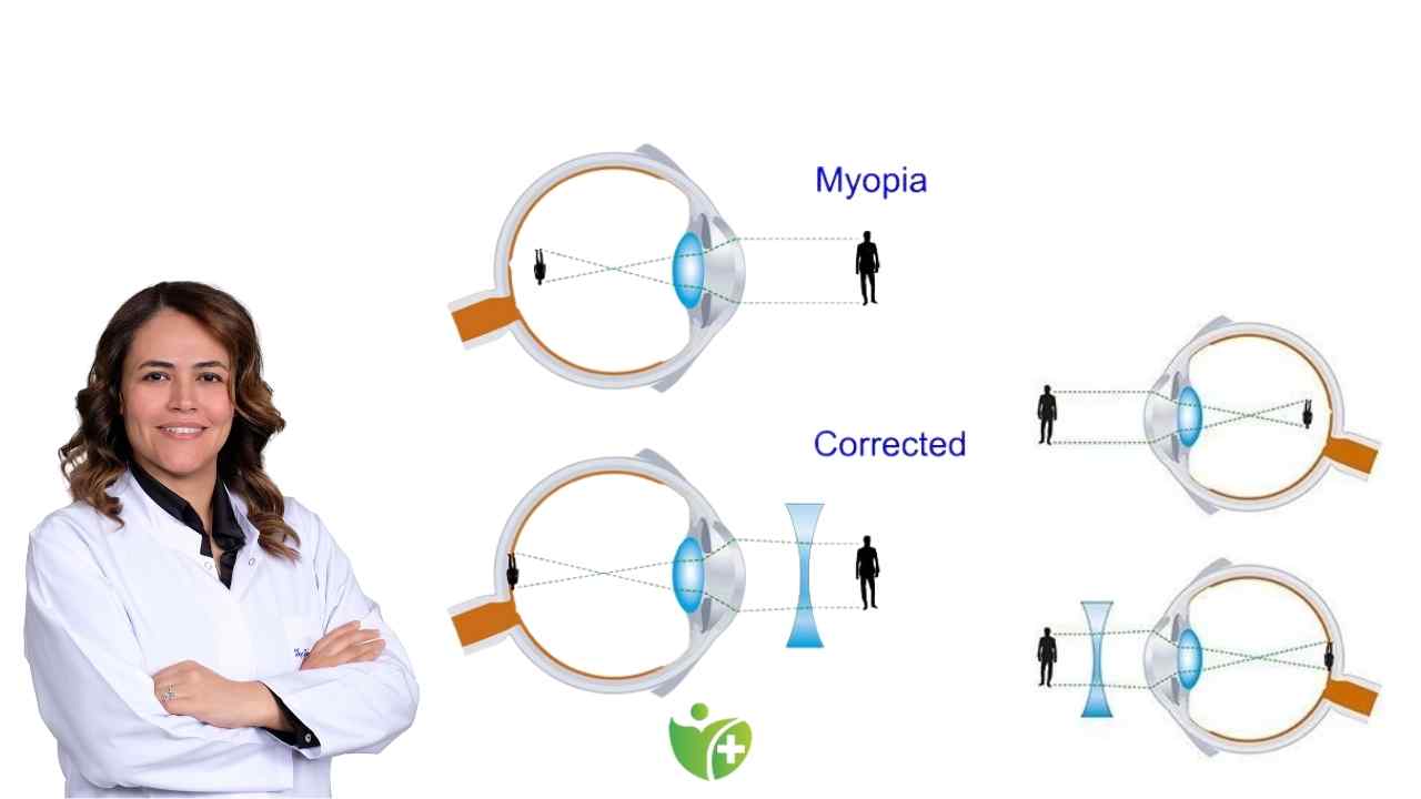 Çocuğunuzun gözleri tehlikede! Miyopiden korunmak için 5 kritik adım! 7