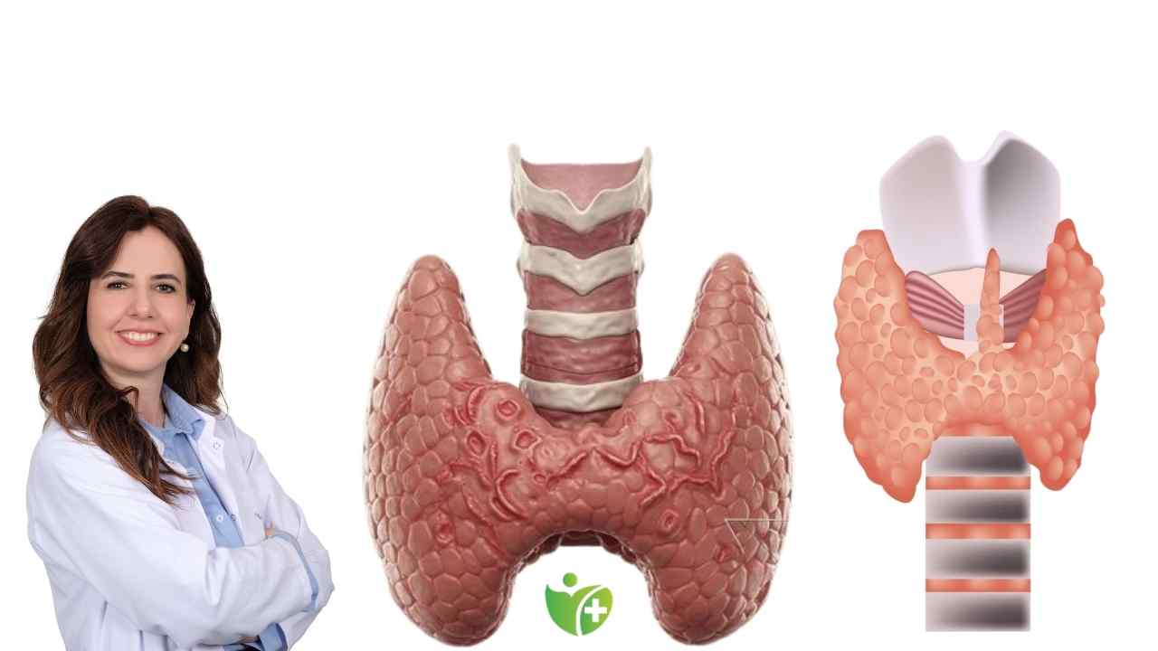 Vücudunuz Hashimoto’ya işaret ediyor olabilir: İşte 10 kritik belirti! 7