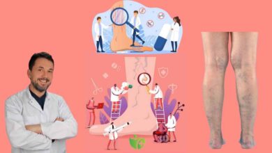 Varis Hastaları yazı nasıl daha konforlu geçirir? İşte 10 etkili yöntem 1