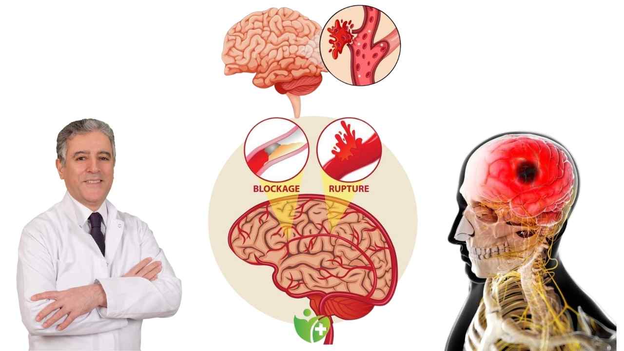 Hipertansiyon hastaları Dikkat! Sıcaklar beyin kanaması riskinizi katlıyor 7