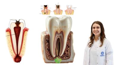 İhmal edilen Diş iltihabı daha büyük problemler doğurur! 1