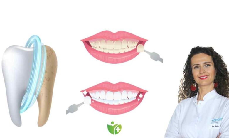 Bilimsel veriler ne diyor? Doğru yöntemlerle yapılan diş beyazlatma güvenli mi? 1