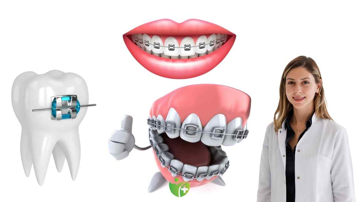 Dişlerdeki Bozukluklar için en etkili dönem: Ergenlikte kemik yapısı daha esnek 7