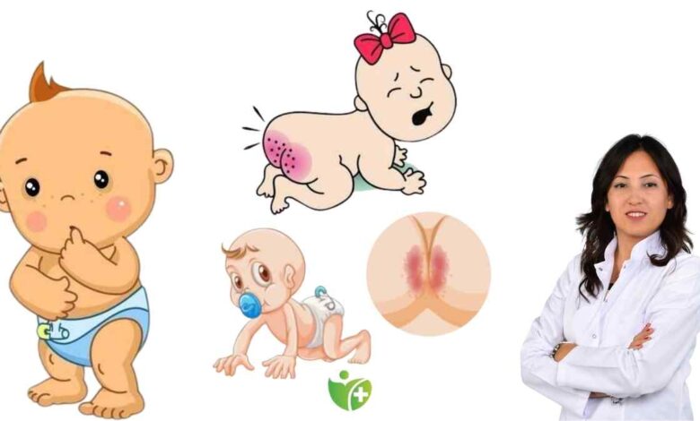 Terleme ve nem pişik yapıyor! Yaz aylarında korunmanın yolları 12