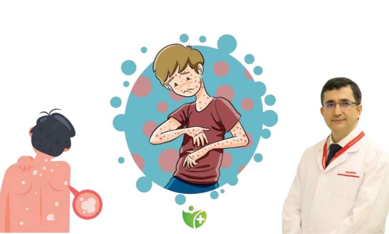 Ciltteki Renk değişiklikleri yaz mantarının ilk belirtisi olabilir 13