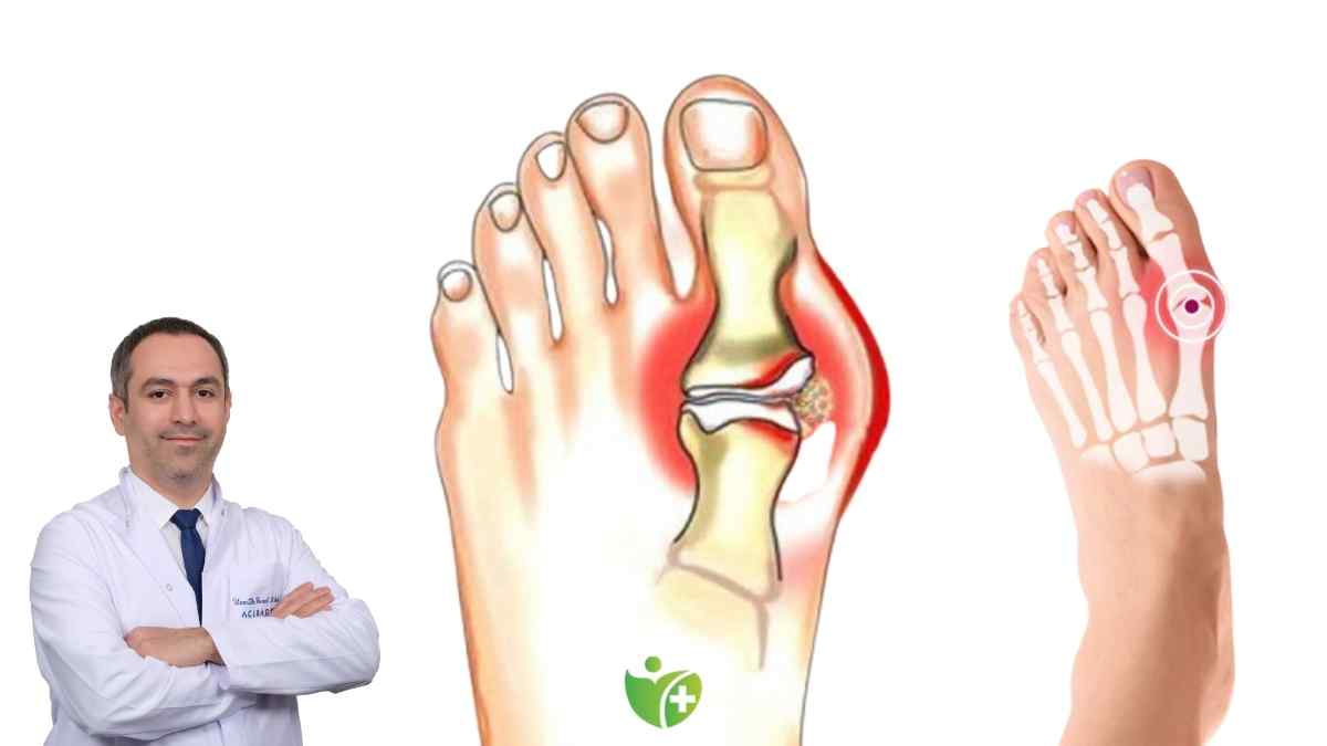 Stres Kırığı nedir? Ayakta çalışmak neden bu riski artırır? 7