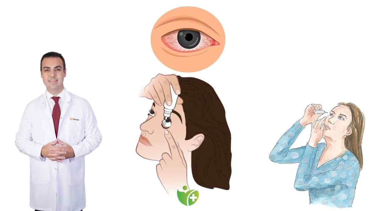 Masum sandığınız Göz Alerjisi kalıcı görme kaybına neden olabilir 7