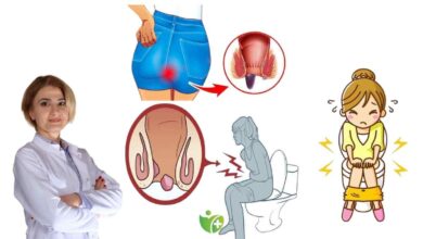 Hemoroidin en büyük düşmanı: Utanma Duygusu! Erken tedavi hayat kurtarıyor 1