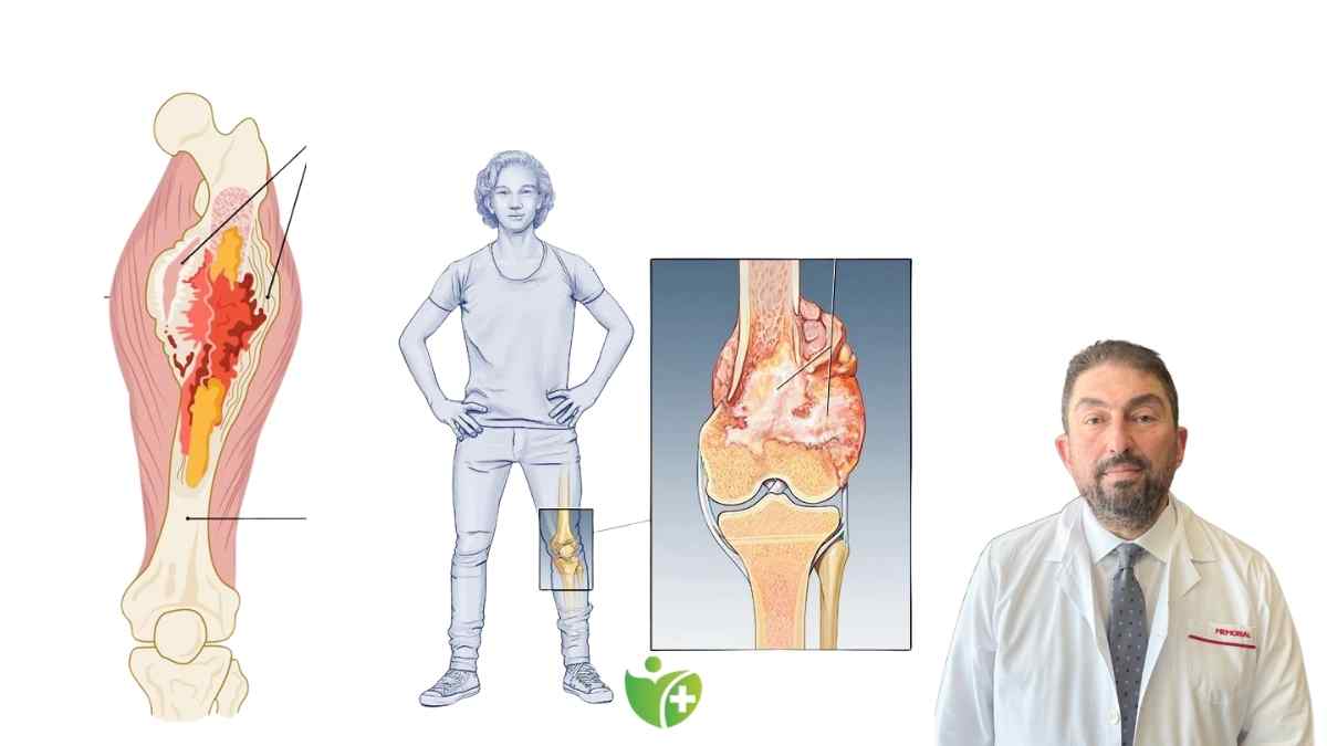 Kemik ağrılarınızı hafife almayın: Kemik tümörlerinin 10 kritik belirtisi 7