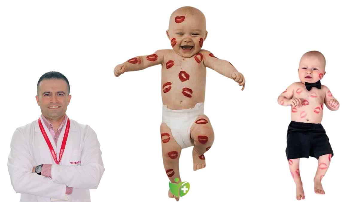 Bebeğinizi öperken onu hastalıklara maruz bırakıyor olabilirsiniz! 7