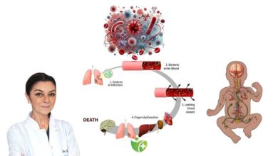 Sessiz katil Sepsis: Dünyada her yıl 30 milyondan fazla kişiyi vuruyor 3