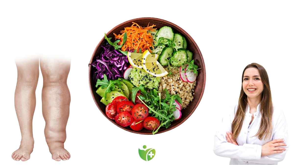 Lipödemle yaşamak artık daha kolay: Anti-inflamatuar diyetten güç alın! 6