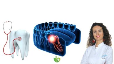 Diş hekimleri açıklıyor: Hangi 20'lik işler çekilmez? 13