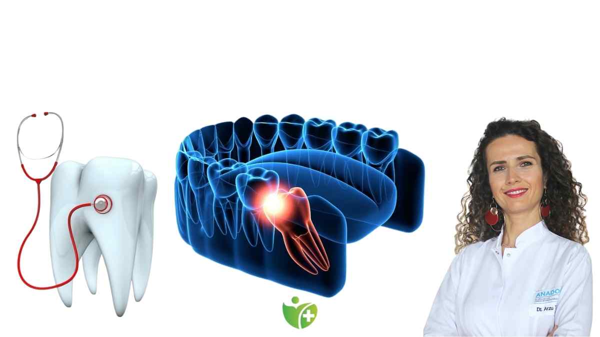 Diş hekimleri açıklıyor: Hangi 20'lik işler çekilmez? 7