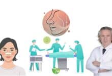 Burun Estetiğinde ikinci deneme: Revizyon Rinoplasti neden özel uzmanlık gerektirir? 32